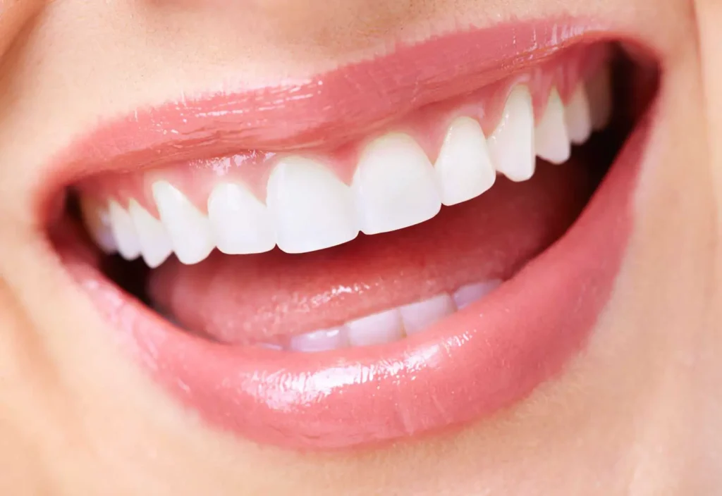 Dental Veneers Abroad: Let’s Clear Things Up