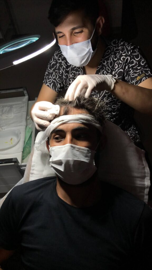 Hair PRP Therapy